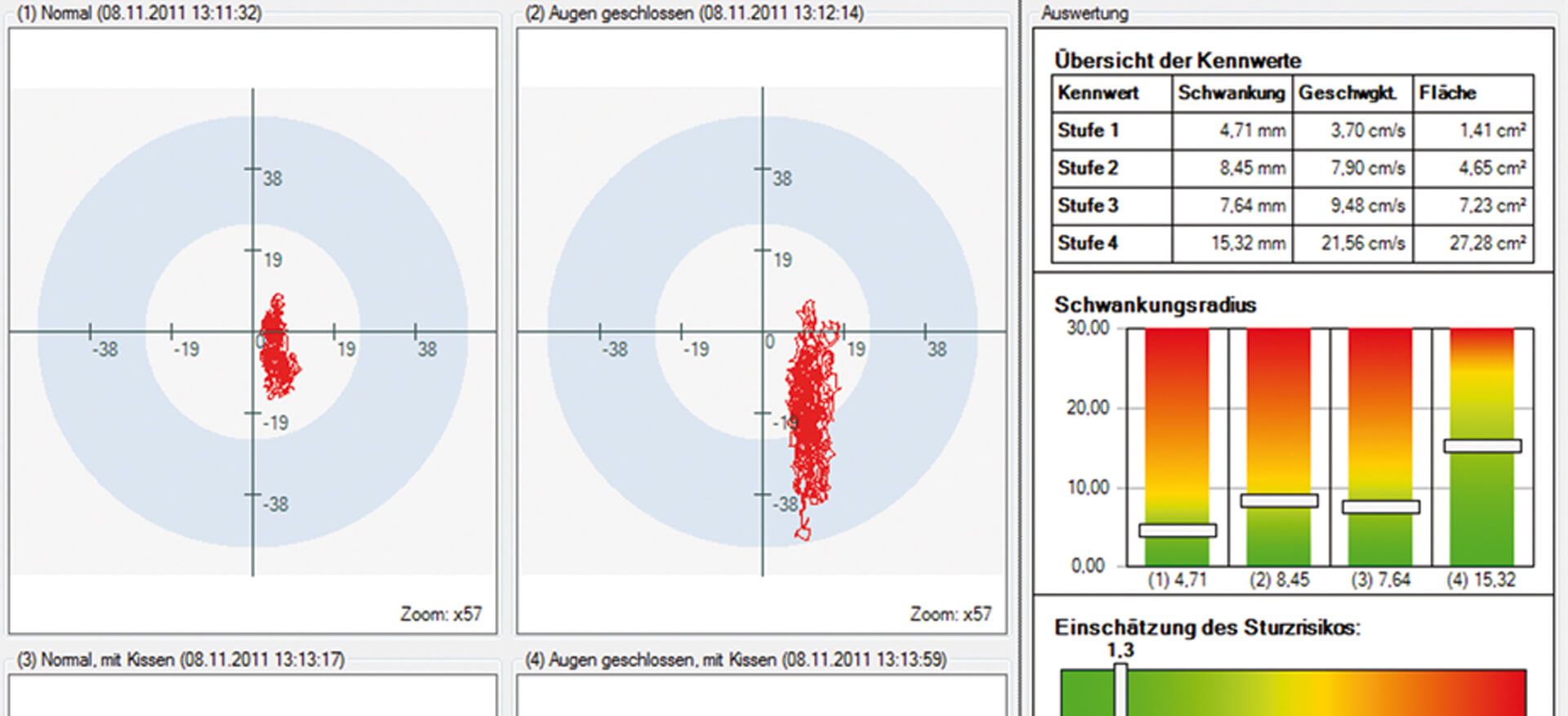 HNO med. Nord